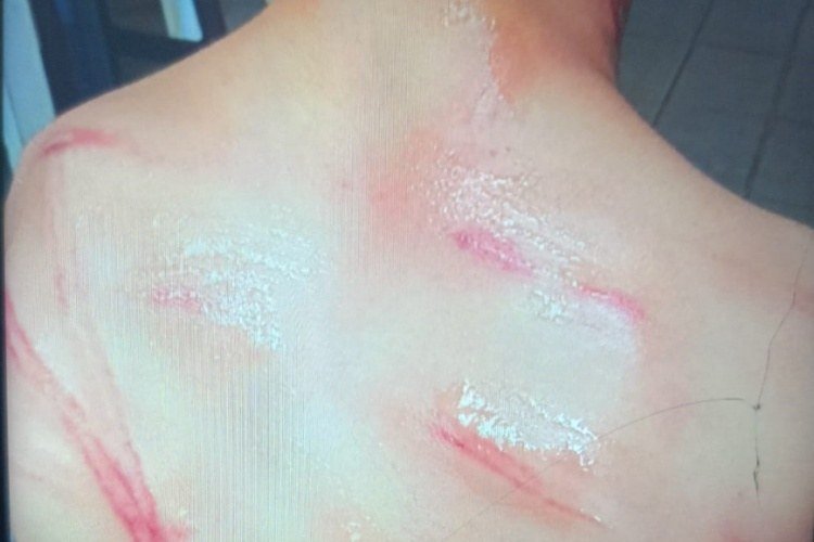 Pai espanca filho em Patrocínio do Muriaé e está foragido